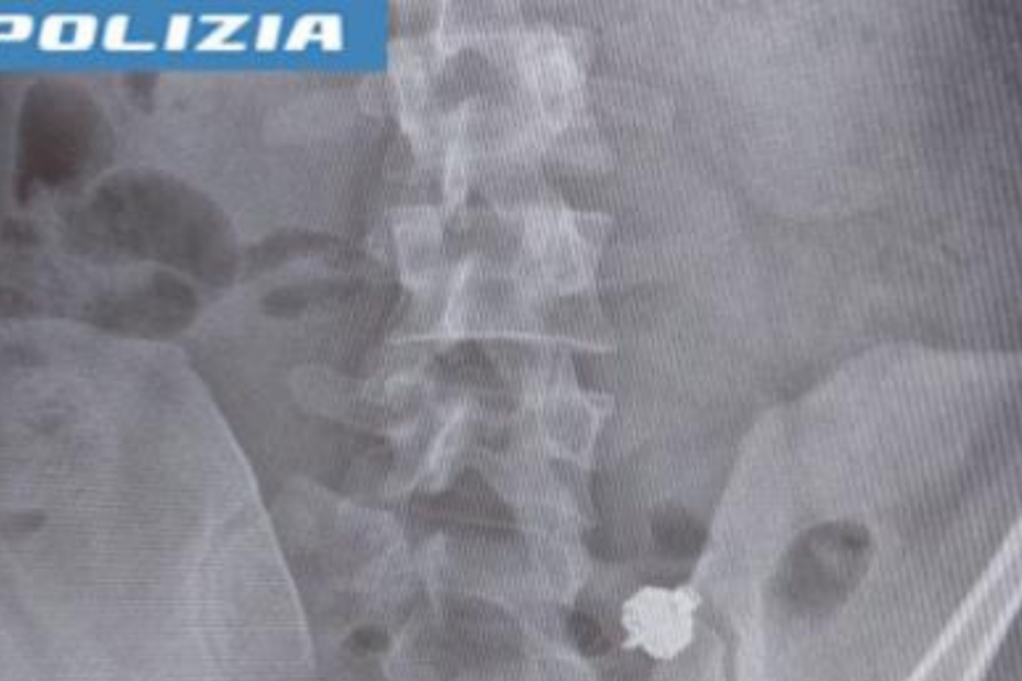 Bara all'esame della patente, lo scoprono e ingoia l'auricolare