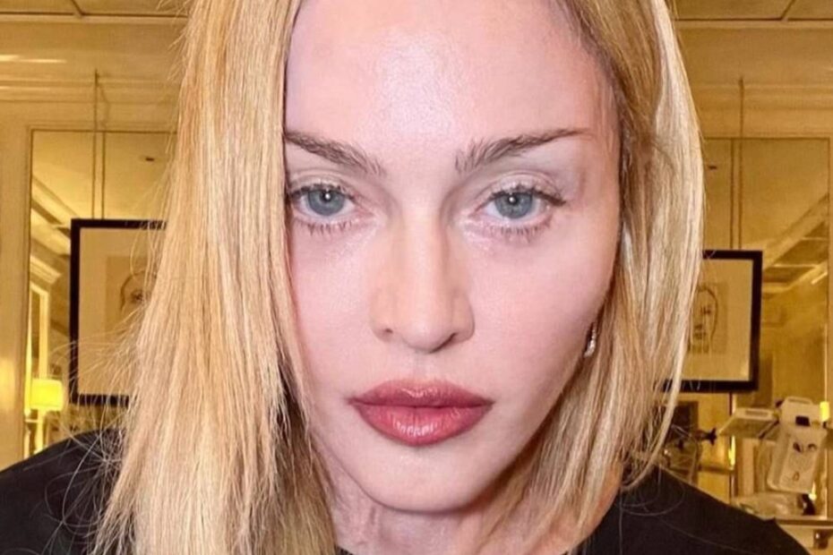 Madonna coma malattia dio