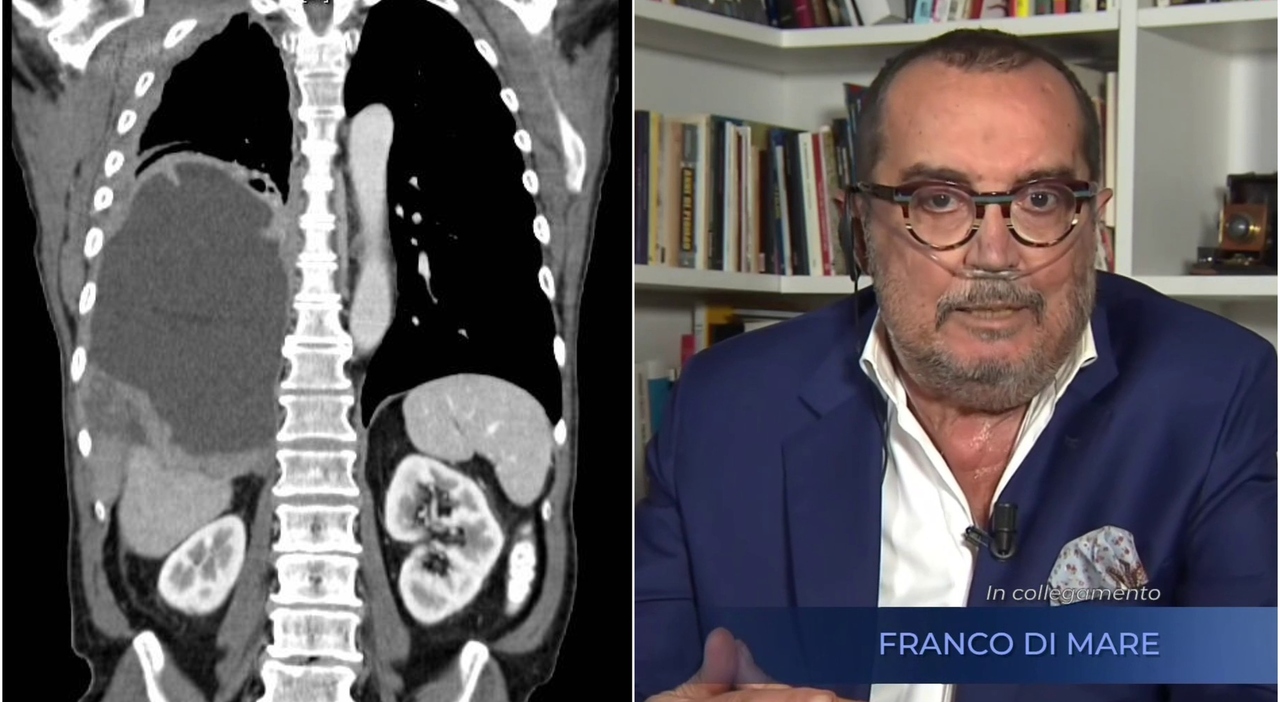 franco Di Mare la Rai replica Non sapevamo della malattia