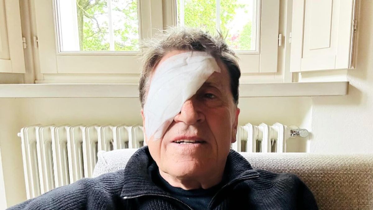 Gianni Morandi, la foto con l’occhio bendato che spaventa i fan: “Ho fatto a pugni”