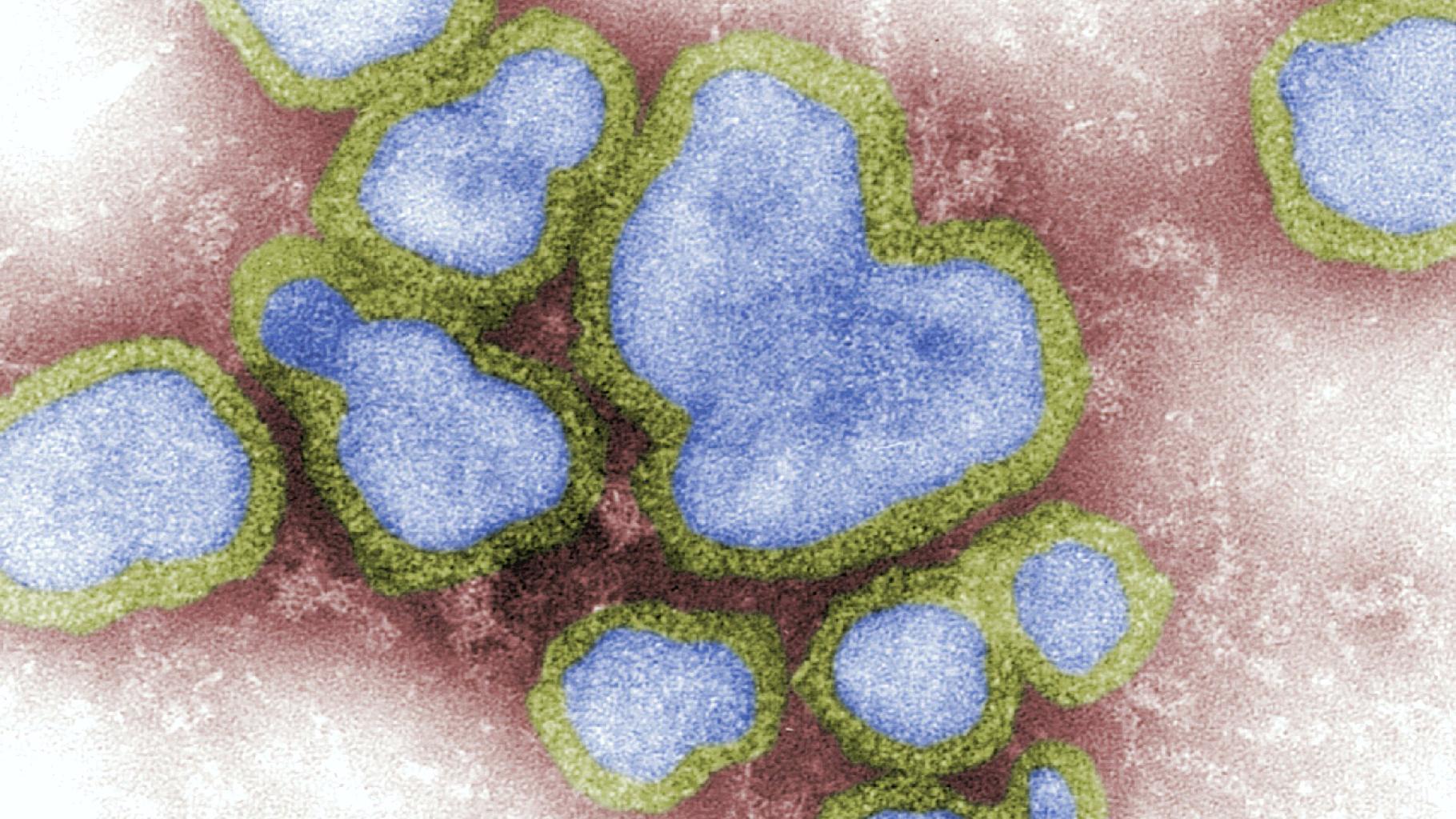 Nuova pandemia, gli scienziati sono certi: la malattia più pericolosa