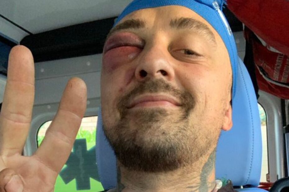 Chef Rubio lesioni aggravate