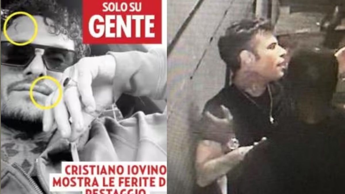 Fedez Iovino foto pestaggio