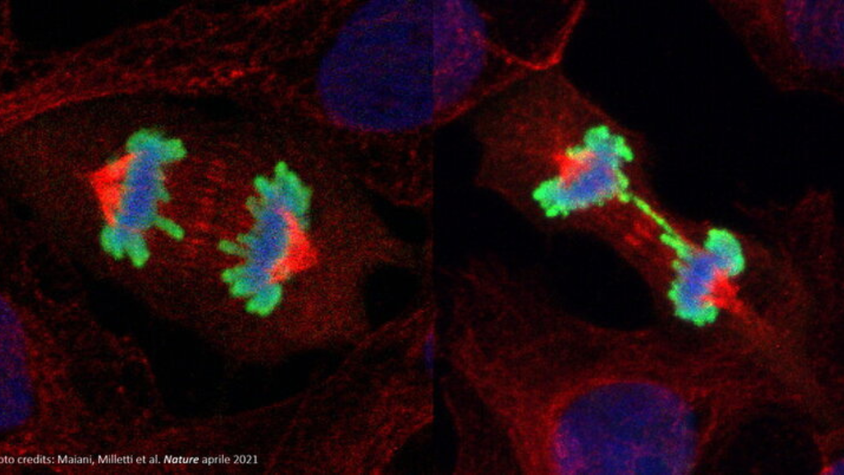 Ricerca, scoperte le proteine che segnalano la formazione di un possibile tumore anche sette anni prima della diagnosi