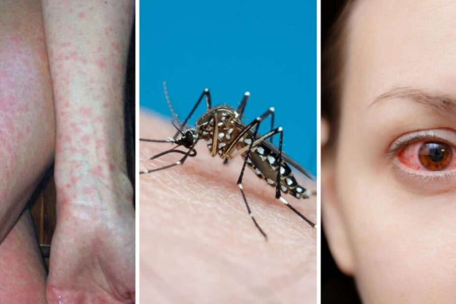 dengue Italia disinfestazione Venezia