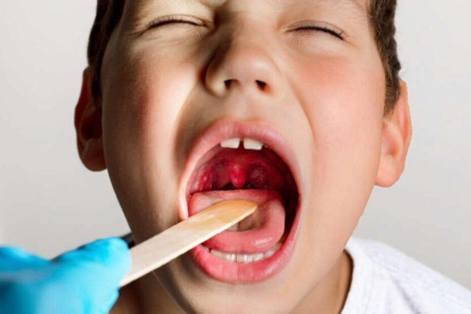 allarme streptococco mancano antibiotici