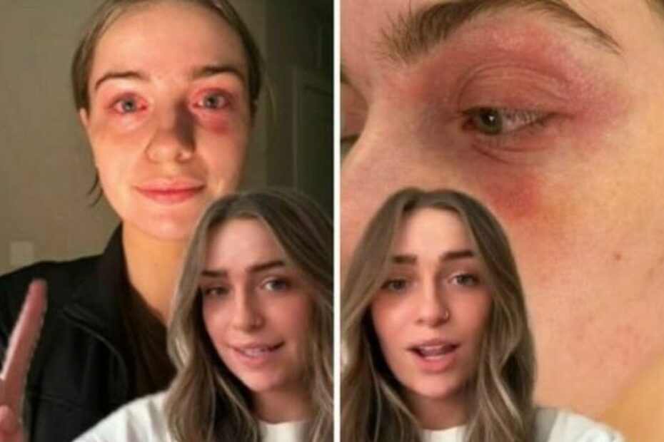Erin orecchini Shein avvelenata