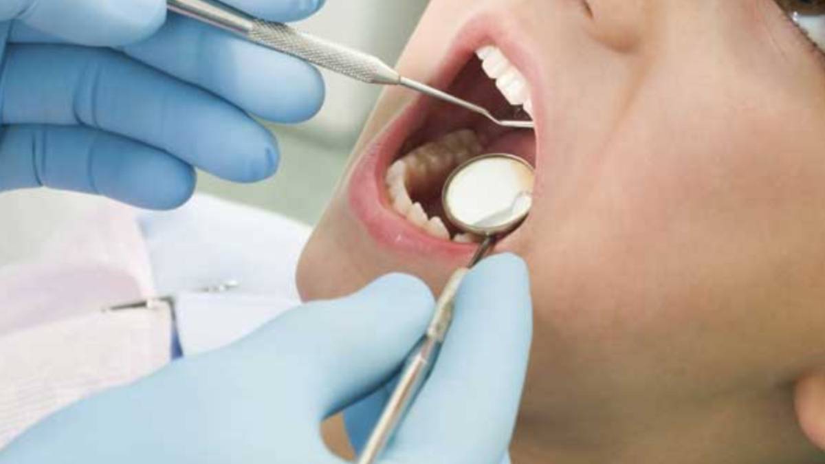 denti di gesso