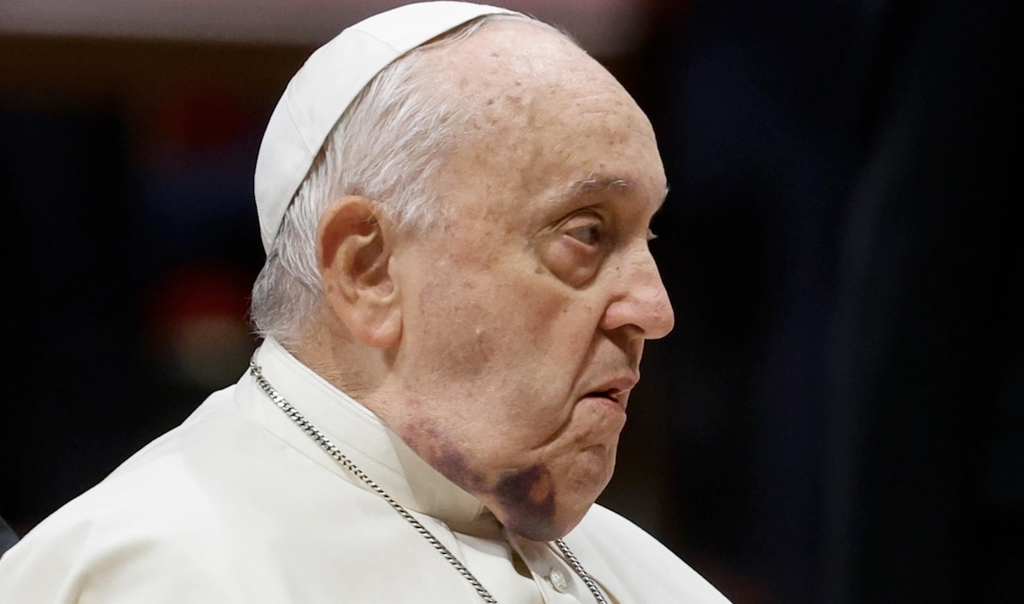Vaticano, Parolin sostituisce Papa Francesco: i riti della Pasqua li presidierà il segretario di Stato Vaticano, Parolin sostituisce Papa Francesco: i riti della Pasqua li presidierà il segretario di Stato