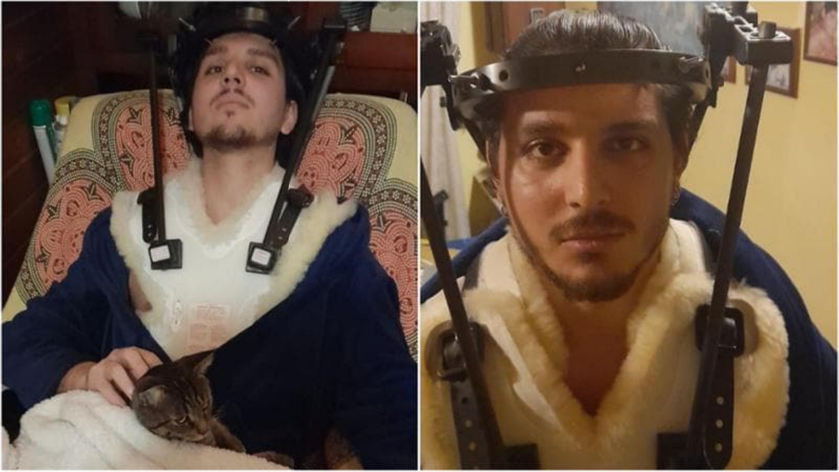 Bologna, travolto da un’auto da un pirata. L’appello di Niccolò: “Vivo per miracolo, costituisciti” Bologna, travolto da un’auto da un pirata. L’appello di Niccolò: “Vivo per miracolo, costituisciti”