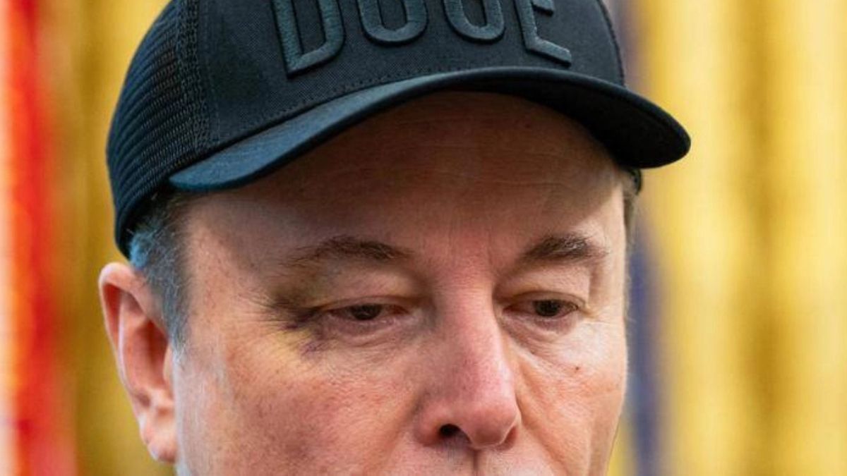 “Mi ha dato un pugno”. Elon Musk si presenta con un occhio nero e racconta tutto “Mi ha dato un pugno”. Elon Musk si presenta con un occhio nero e racconta tutto