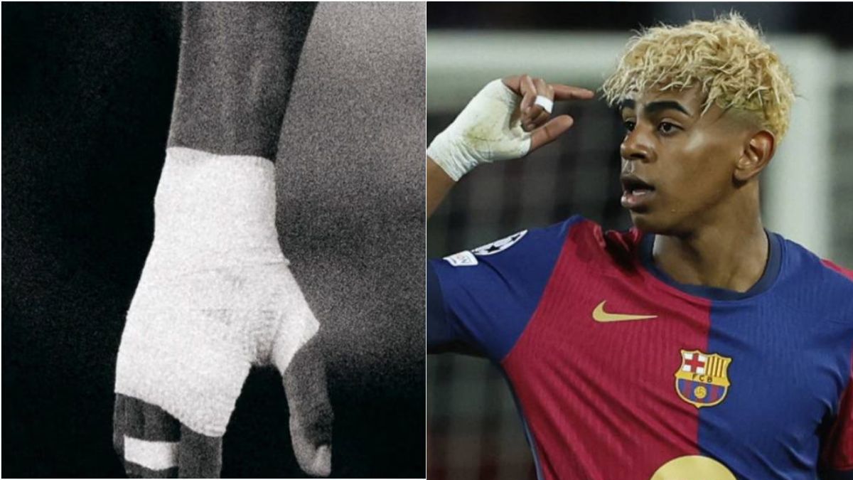 “Le bende ai polsi? Ecco perché…”, arriva la risposta dei calciatori del Barcellona “Le bende ai polsi? Ecco perché…”, arriva la risposta dei calciatori del Barcellona