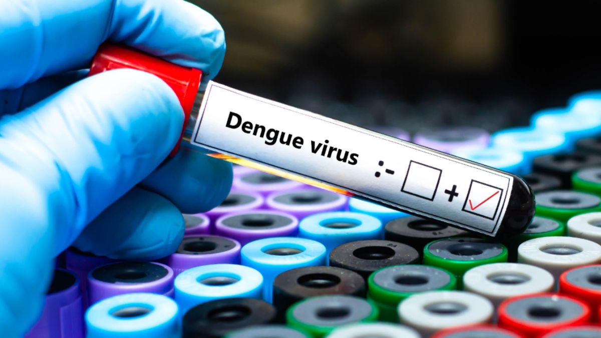 Dengue, torna l’allarme in Italia: l’avvertimento di Bassetti Dengue, torna l’allarme in Italia: l’avvertimento di Bassetti