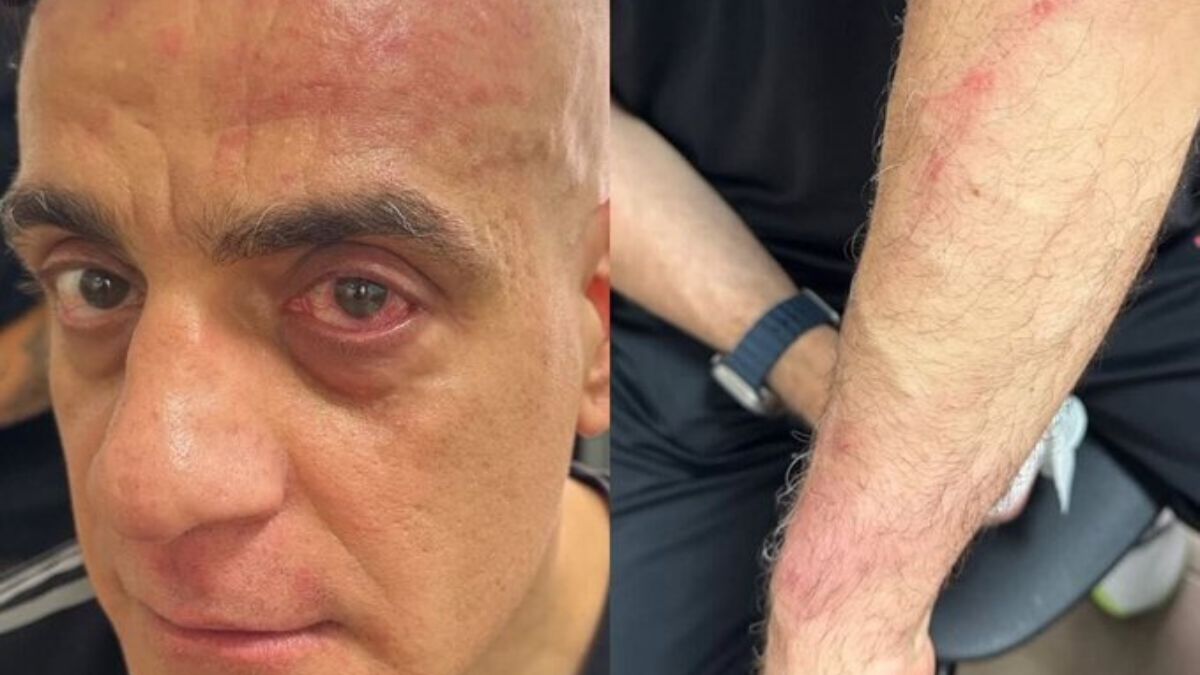 Cicalone, lo youtuber romano aggredito alla stazione di Napoli: “Qui non fate video” Cicalone, lo youtuber romano aggredito alla stazione di Napoli: “Qui non fate video”
