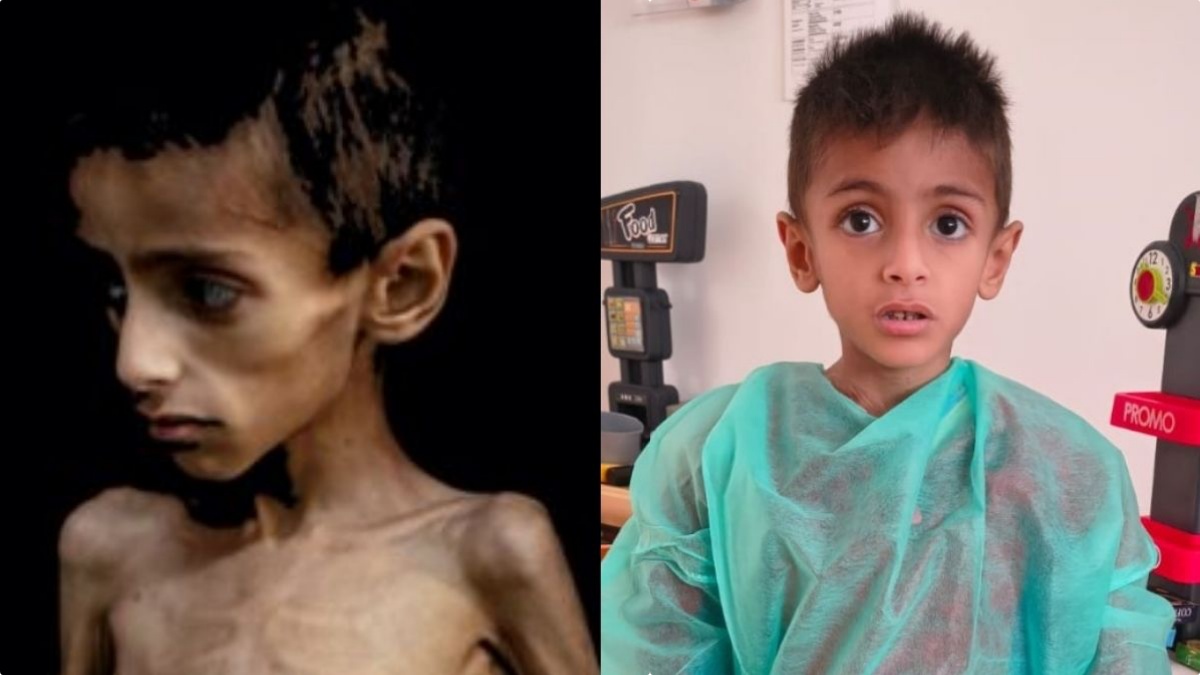 “Lui ora…”. Tutta la verità sul bambino simbolo della fame a Gaza “Lui ora…”. Tutta la verità sul bambino simbolo della fame a Gaza