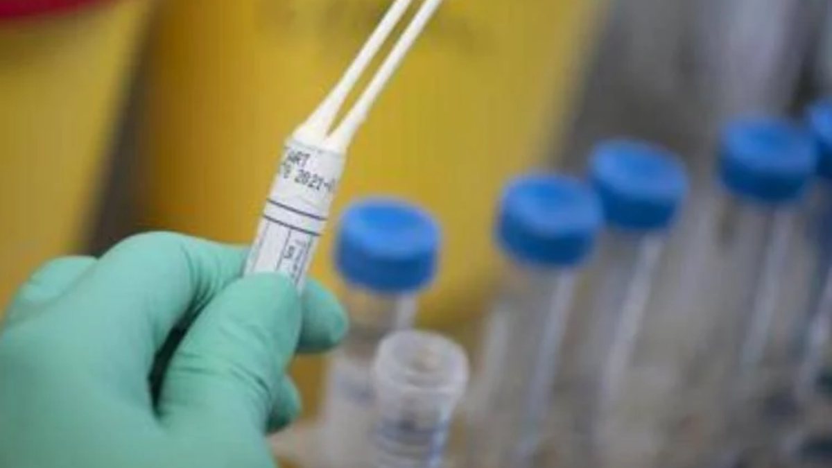Italia, focolaio di legionella: il bilancio è davvero terribile