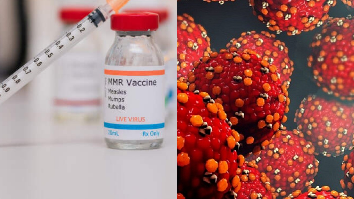 Emergenza Morbillo in Italia, la richiesta shock sui vaccini: “A tappeto…” Emergenza Morbillo in Italia, la richiesta shock sui vaccini: “A tappeto…”