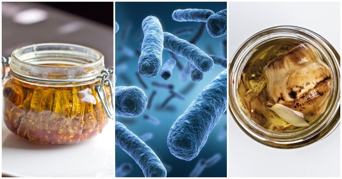 intossicazione da botulino oltre la paura tutto quello che bisogna sapere