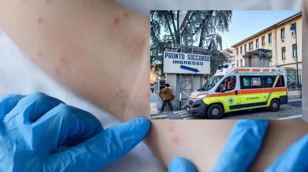 molto contagiosa allarme in italia boom della malattia infettiva a cosa fare attenzione i sintomi