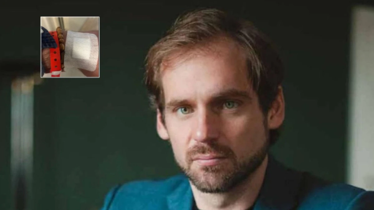 Tomaso Trussardi sorprende tutti: la foto col cerotto e il (quasi) ritorno sui social