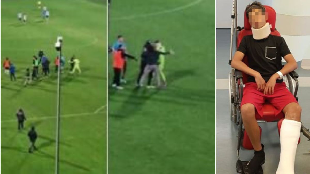 Follia durante la partita, padre entra in campo e pesta a sangue il giocatore di 13 anni: “Perché l’ha fatto” Follia durante la partita, padre entra in campo e pesta a sangue il giocatore di 13 anni: “Perché l’ha fatto”