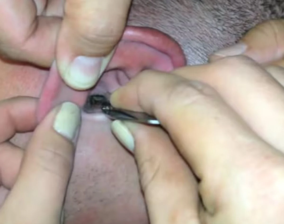 Medico Ospedale Orecchio Paziente