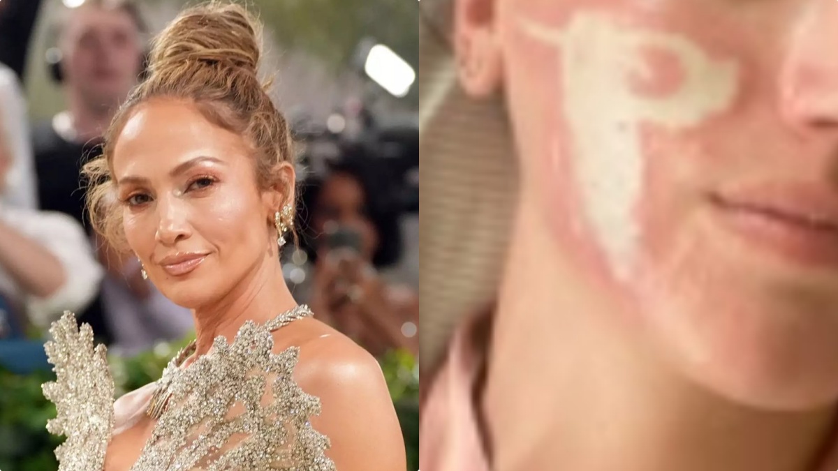Guai grossi per la ‘fidata’ di Jennifer Lopez: “Mi ha sfigurato la faccia”. È scandalo