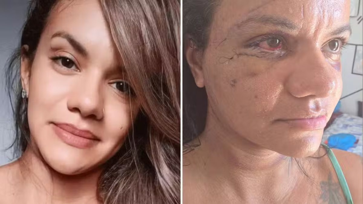 Massacrata dall’ex in ascensore, dopo l’aggressione rivela: “Ecco perché non l’ho denunciato”