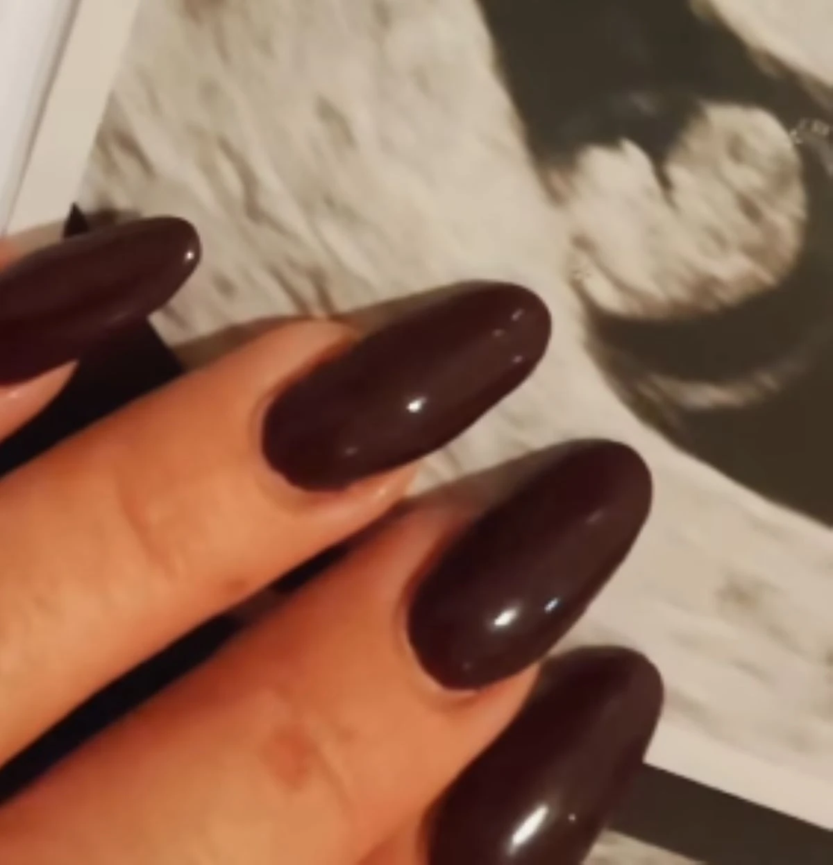 Cantante Perde Figlio