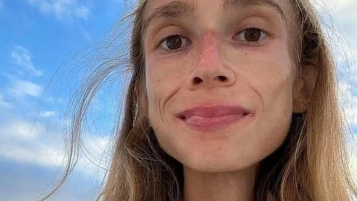 Influencer di 27 anni trovata morta in casa: il dramma dietro la dieta estrema
