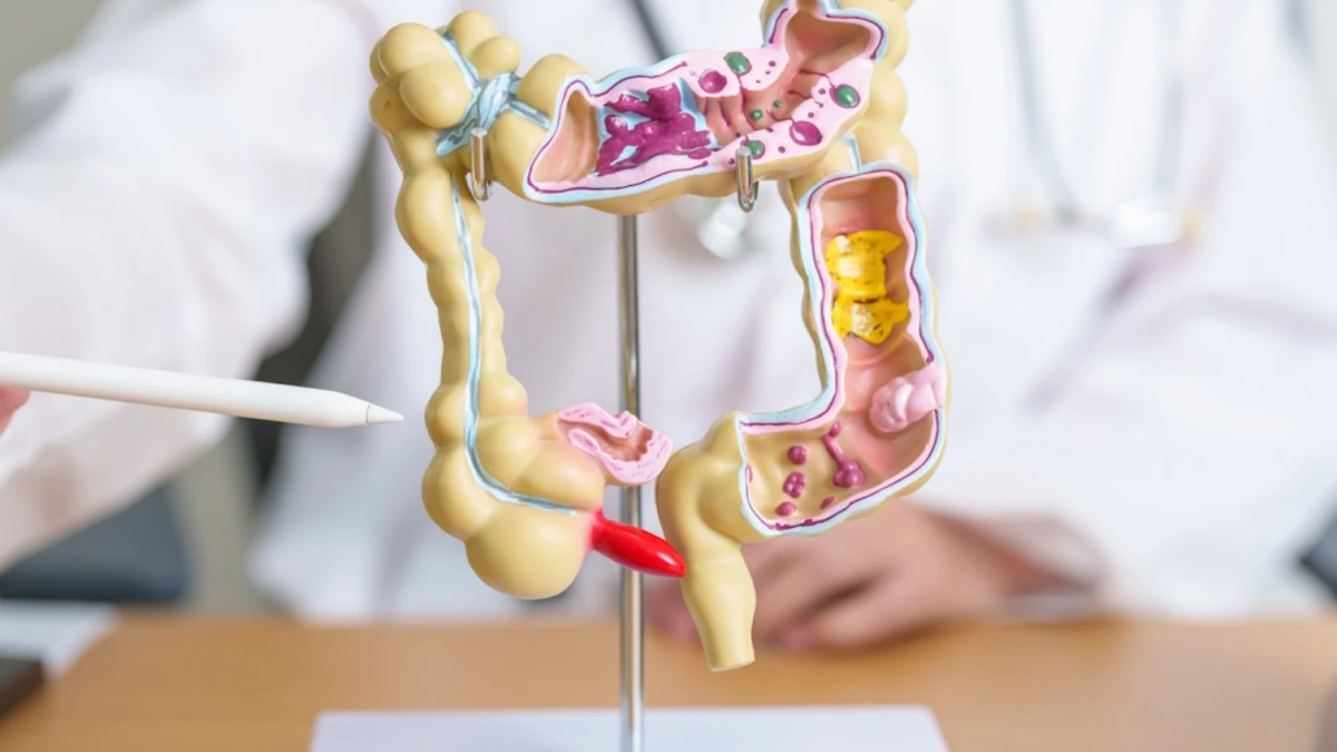 “Tumore al colon, i 5 segnali da non ignorare”: l’allarme dell’oncologo, a cosa dobbiamo stare attenti “Tumore al colon, i 5 segnali da non ignorare”: l’allarme dell’oncologo, a cosa dobbiamo stare attenti