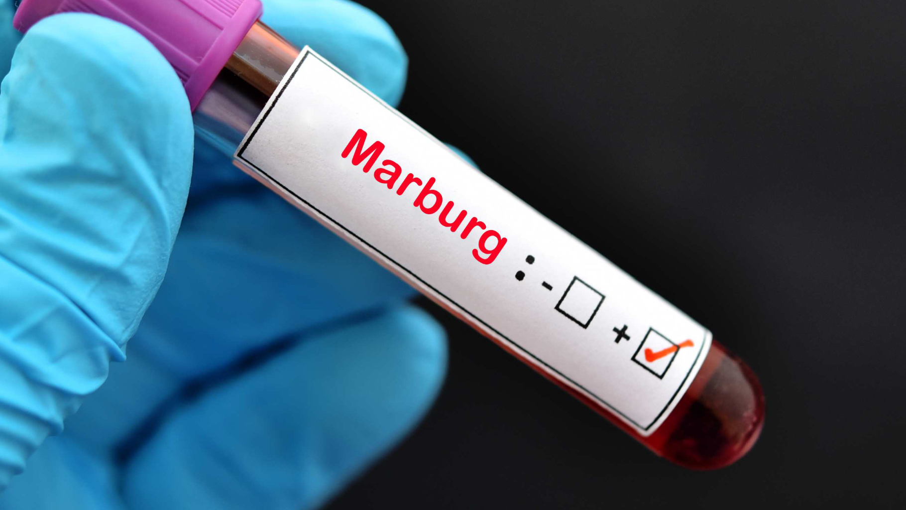 Paura, tre morti per il virus emorragico Marburg: le misure d’emergenza