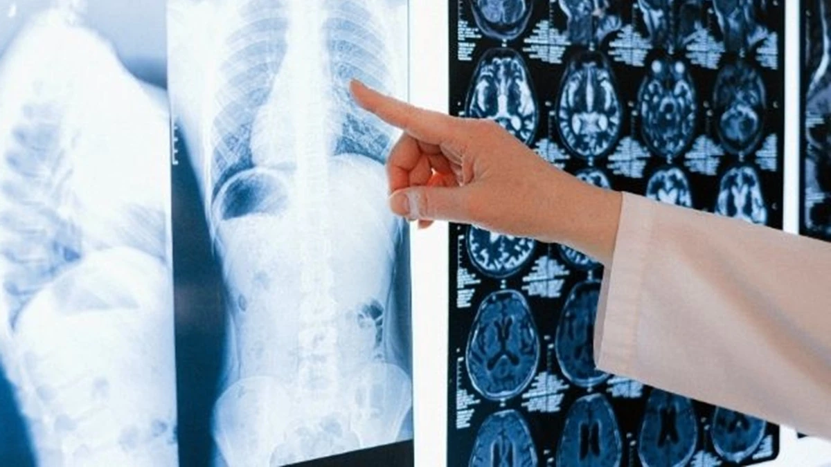 “Tumori, attenti a quei 4 sintomi”. L’allarme degli esperti: “Non vanno mai sottovalutati” “Tumori, attenti a quei 4 sintomi”. L’allarme degli esperti: “Non vanno mai sottovalutati”