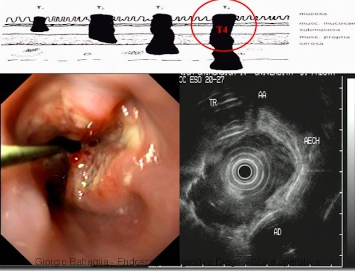Gastroscopia in corso in un centro medico