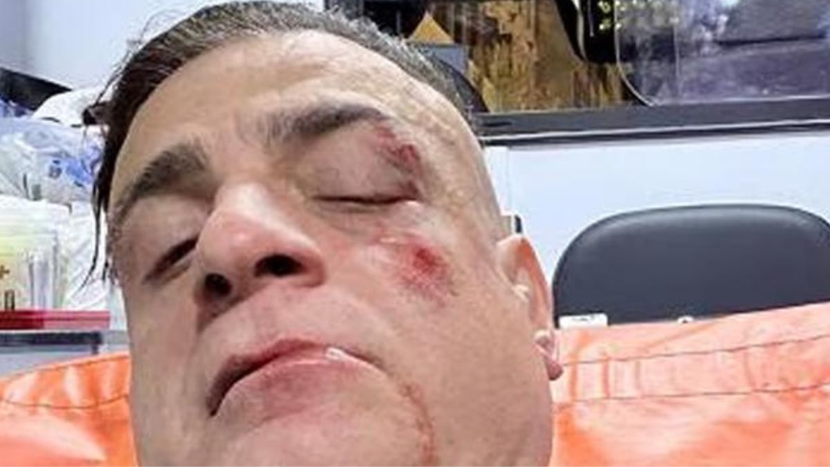 “Infami veri, da dietro in 10”. Aggredito il famoso youtuber, è shock