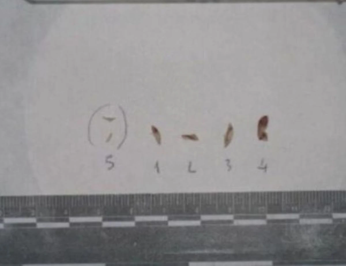 Reperti unghie Chiara Poggi caso Garlasco