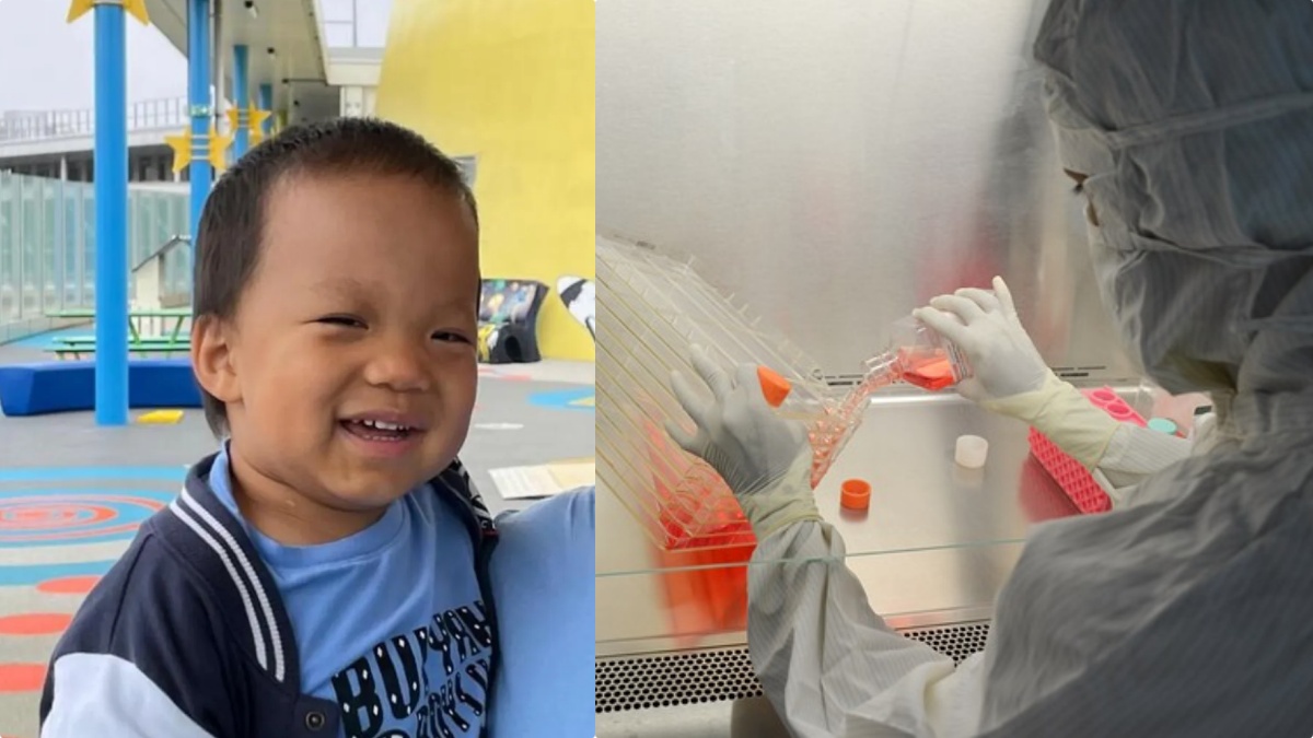 Svolta mondiale per la sindrome di Hunter: bimbo di 3 anni reagisce alla terapia genica