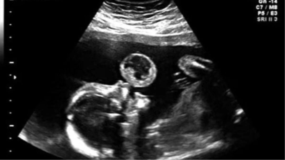 “Mia figlia fa le bolle”. Vede l’ecografia e scoppia a ridere, ma il medico la gela: scoperta shock