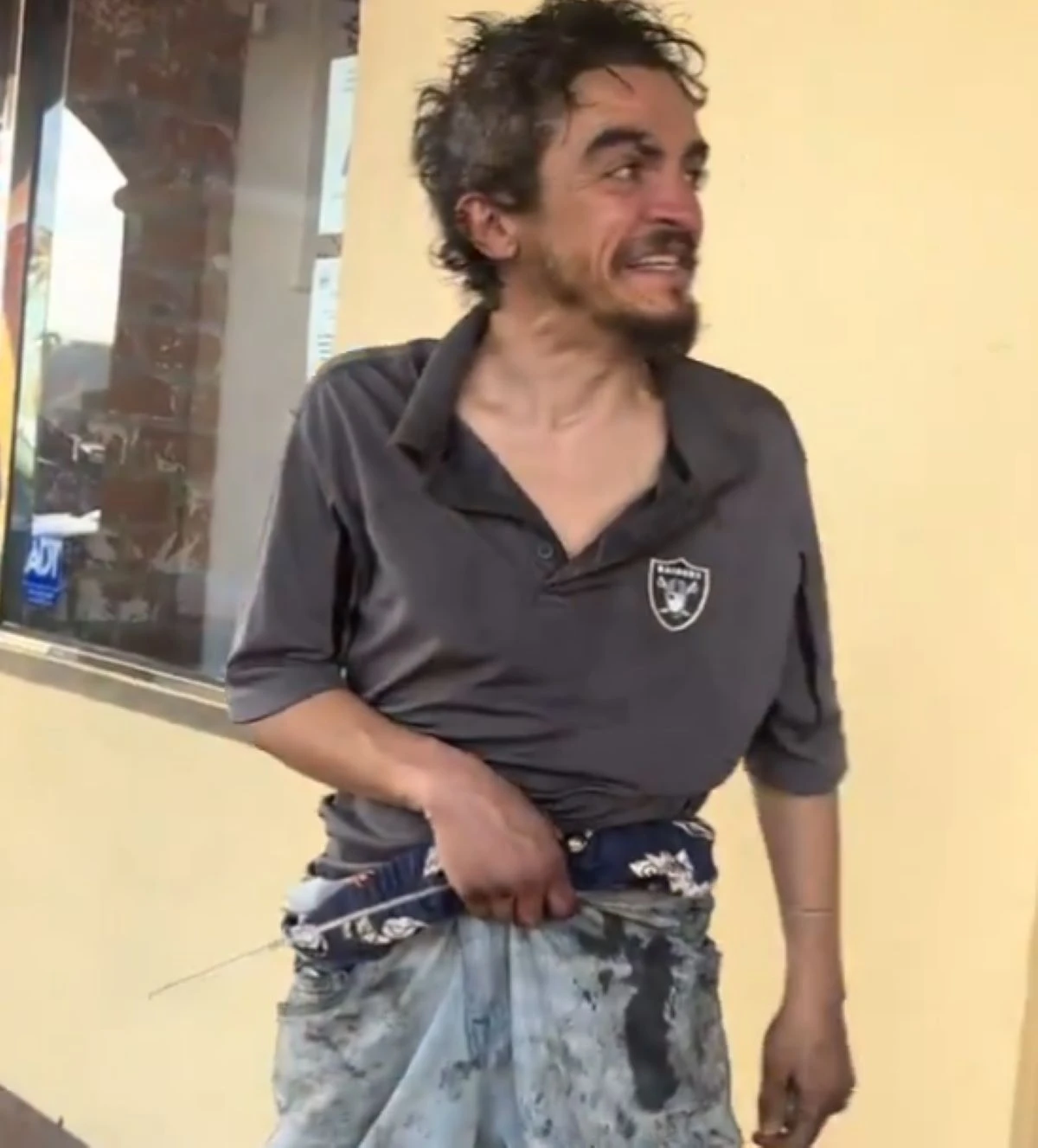 Tylor Chase in strada in condizioni di senzatetto a Los Angeles
