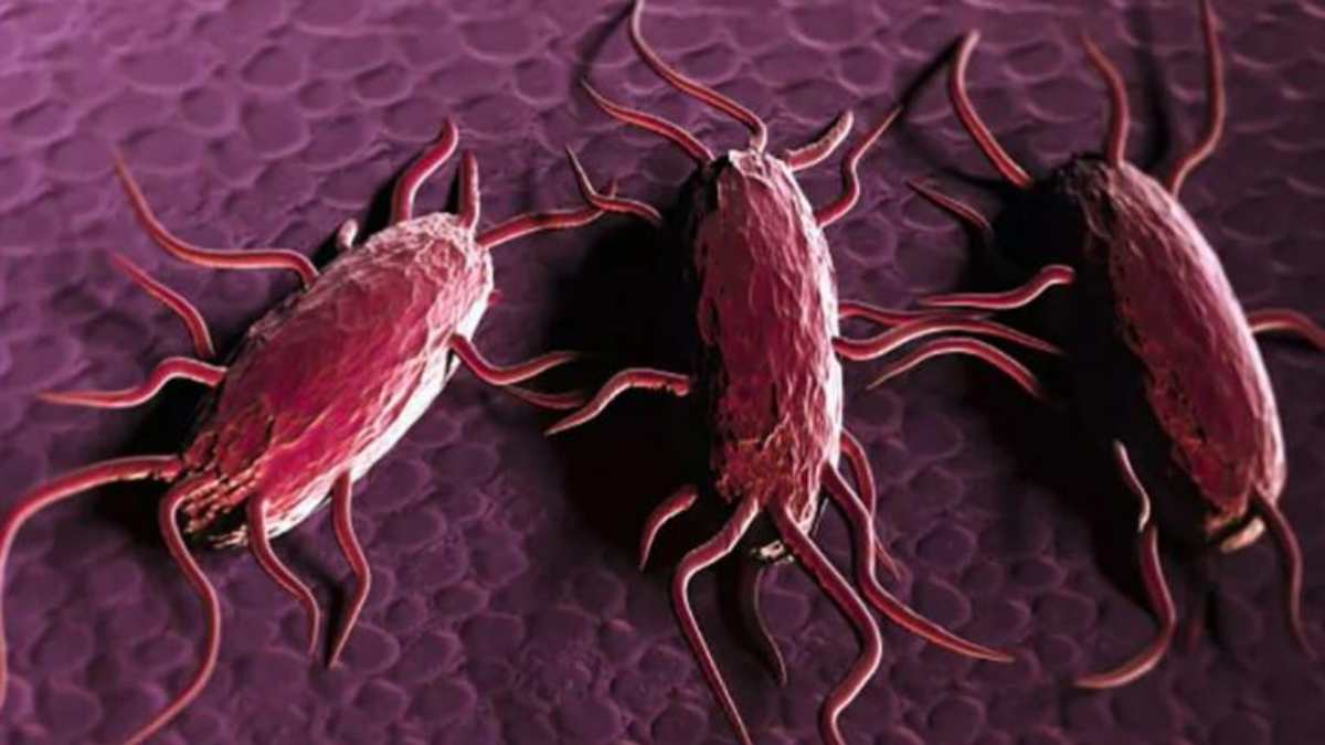 listeriosi in aumento in europa 232 l8217infezione alimentare pi249 grave per ricoveri e decessi