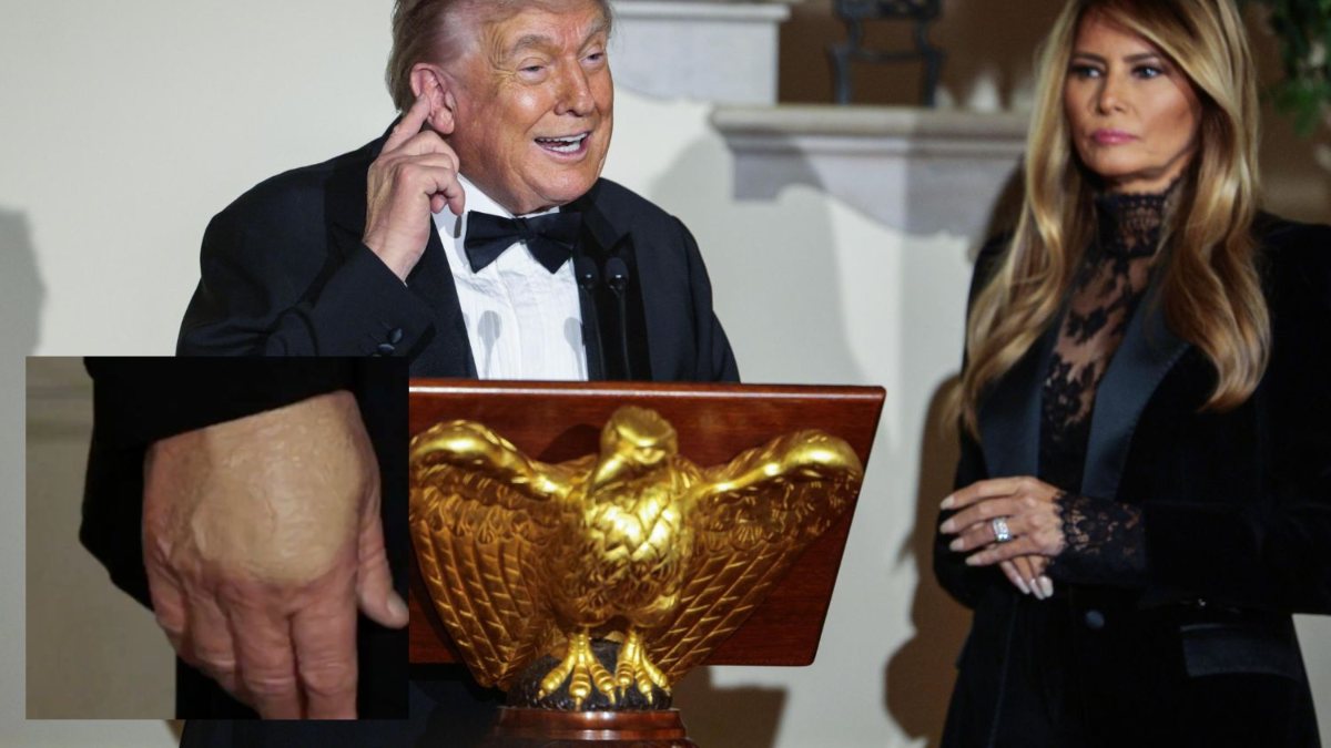 ma di che colore ce l8217ha trump quel particolare sul suo corpo non 232 sfuggito come sta veramente