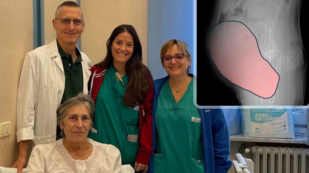 pesava 6 chili italia la scoperta shock nell8217utero di una paziente poi accade l8217incredibile da Thesocialpost.it pesava 6 chili italia la scoperta shock nell8217utero di una paziente poi accade l8217incredibile