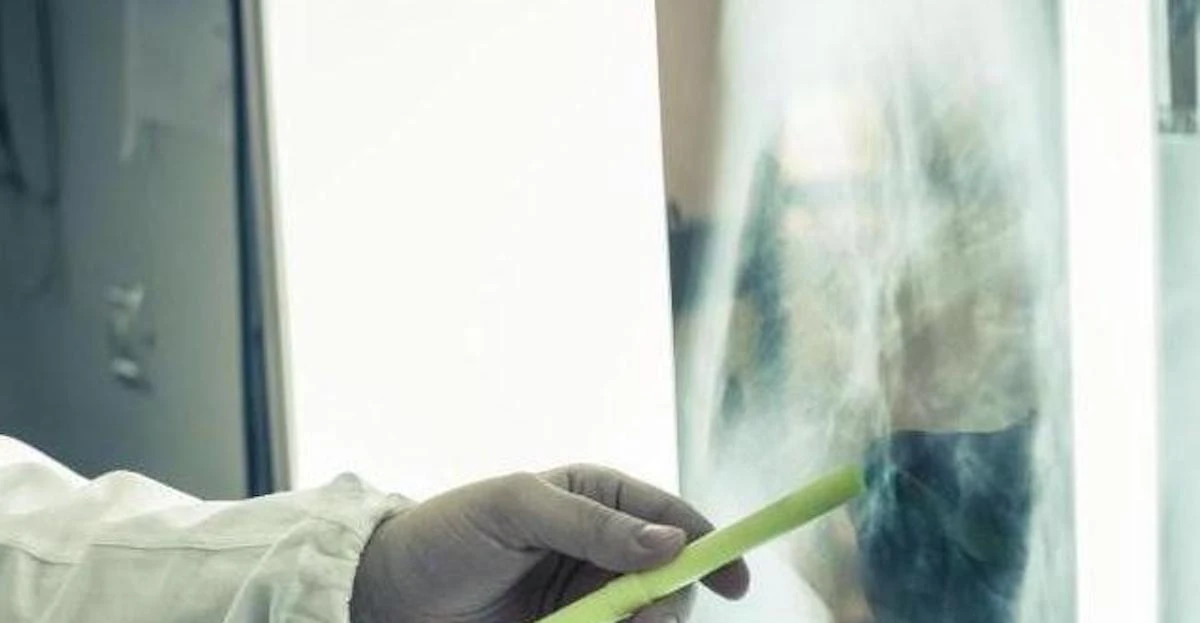 provoca cancro ai polmoni e alla bocca nuovo studio gli esperti lanciano l8217allarme da Thesocialpost.it provoca cancro ai polmoni e alla bocca nuovo studio gli esperti lanciano l8217allarme