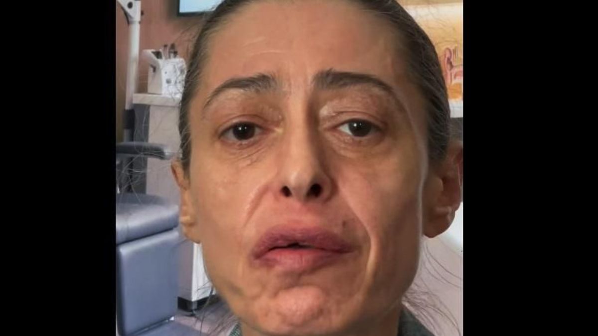 Gerardina Trovato ferma il tour 2026: “Devo operarmi d’urgenza alla gola”
